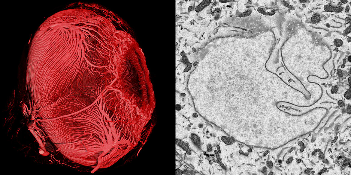 MicroCT und TEM Image